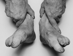 Hands Holding Feet, 1985
